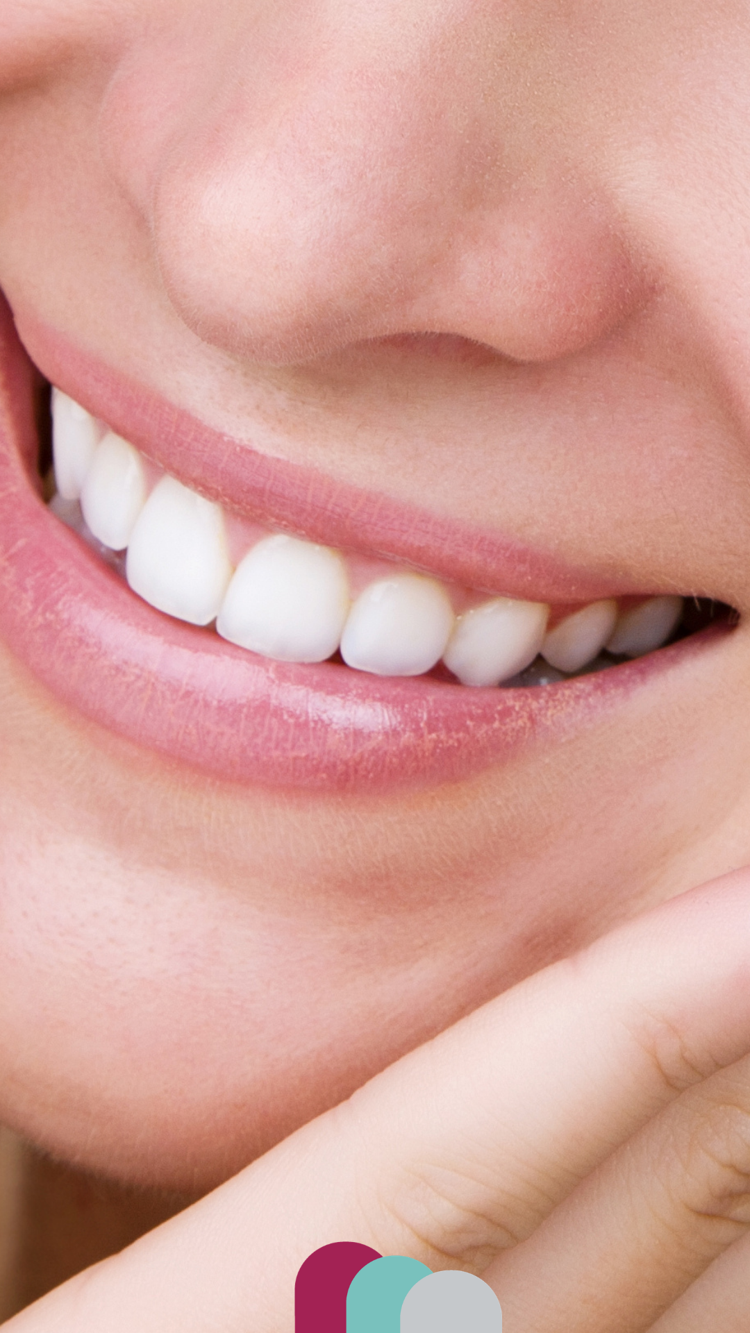 veneers in northampton